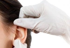 Atlėpusių ausų korekcija: užgaida ar būtinybė?