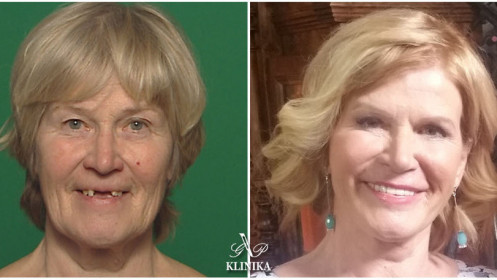 Anglijos lietuvius gražins garsūs gydytojai [dalyvauk projekte!]