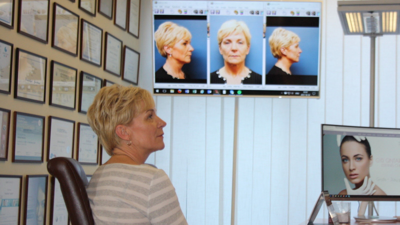 Emigrantų grožio projekto nugalėtoja priartėjo prie plastinės chirurgijos pokyčių