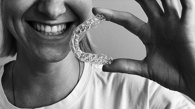 Nauja galimybė JK lietuviams – dantų tiesinimas be breketų Londone