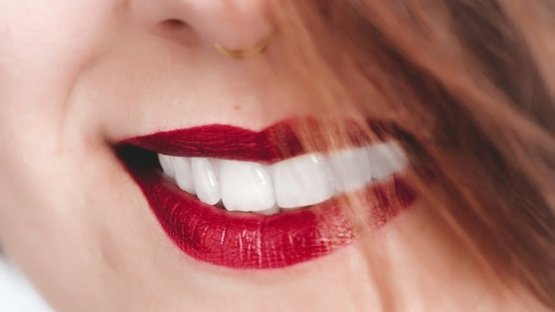 JK lietuvių patogumui – dantų implantacija Londone