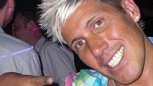 Britas leidžiasi kiniškus vaistus, kad oda būtų tamsesnė, dėl to jau negavo būsto paskolos