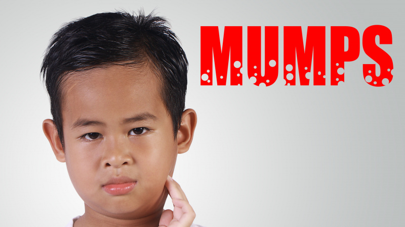 Kiaulytės atvejų skaičius Anglijoje – didžiausias per dešimt metų