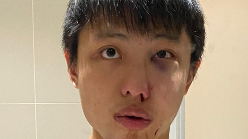 Londone – rasistinis išpuolis: nenoriu tavo koronaviruso savo šalyje