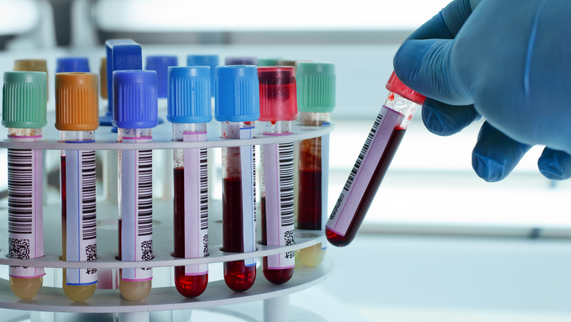 Anglijoje aprobuotas potencialą turintis koronaviruso antikūnų testas