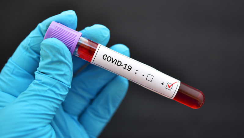 JK tapo antrąja šalimi, kur mirčių nuo koronaviruso skaičius viršijo 40 tūkst.