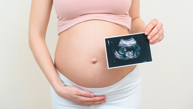 Ekspertai: koronaviruso pandemija gali sukelti „kūdikių bumą“