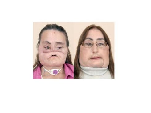 Amerikietei persodintas mirusios moters veidas