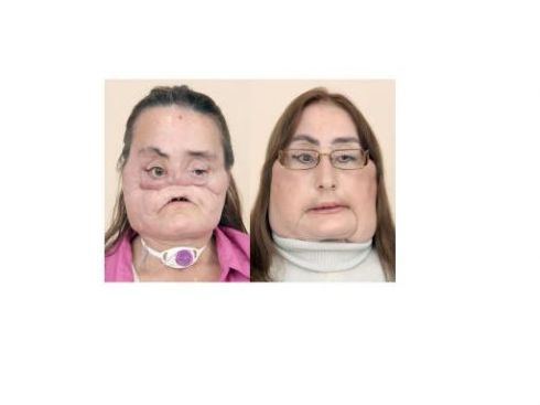 Moteris be veido: aš – ne monstras 